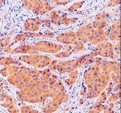 Human/Mouse/Rat PKC alpha Antibody, R D Systems 100 &mu;g | Buy Online | R&D Systems | Fisher Scientific