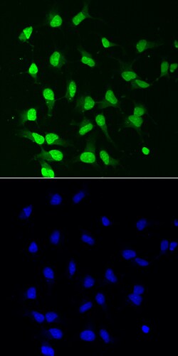 Human/Rat PKC beta 1 Antibody, R D Systems 25&mu;g; Unlabeled:Antibodies,