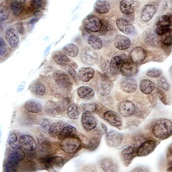 Human PKC epsilon Antibody, R D Systems 100ug; Unlabeled:Antibodies, Monoclonal