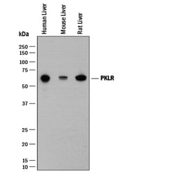 Human/Mouse/Rat PKLR Antibody, R D Systems 100&mu;L:Antibodies, Polyclonal