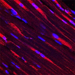 Human/Rat PKM1/2 Antibody, R D Systems 100 &mu;g | Buy Online | R&D Systems | Fisher Scientific