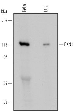 Human/Mouse PKN1 Antibody, R D Systems 100ug; Unlabeled:Antibodies, Monoclonal