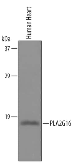 Human PLA2G16 Antibody, R D Systems 100&mu;g; Unlabeled:Antibodies, Polyclonal