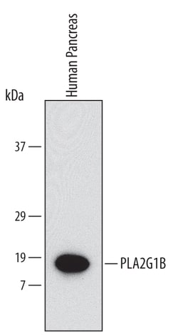 Human PLA2G1B Antibody, R D Systems 100ug; Unlabeled:Antibodies, Monoclonal