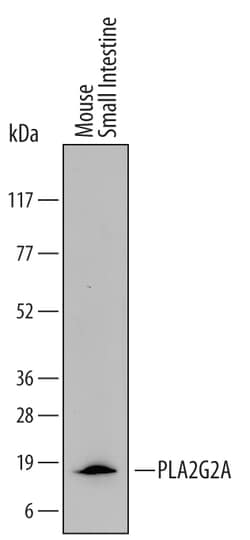 Mouse PLA2G2A Antibody, R D Systems 100&mu;g; Unlabeled:Antibodies, Polyclonal