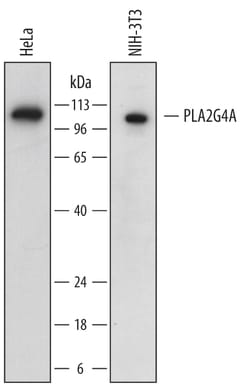 Human/Mouse PLA2G4A Antibody, R D Systems 25&mu;g; Unlabeled:Antibodies,