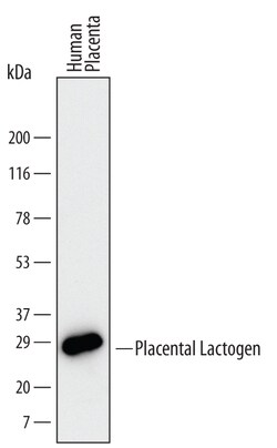 Human Placental Lactogen/CSH1 Antibody, R D Systems 25&mu;g; Unlabeled:Antibodies,