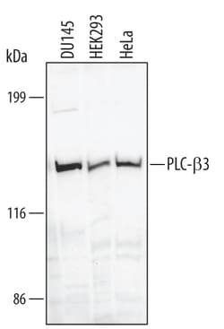 Human PLC-beta 3 Antibody, R D Systems 25&mu;g; Unlabeled:Antibodies, Polyclonal