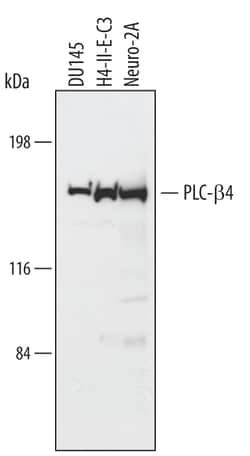 Human/Mouse/Rat PLC-beta 4 Antibody, R D Systems 100&mu;g; Unlabeled:Antibodies,