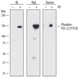 Human Phospho-PLC-gamma 2 (Y753) Antibody, R D Systems 25&mu;g; Unlabeled:Antibodies,