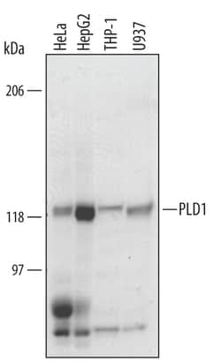Human PLD1 Antibody, R D Systems 25&mu;g; Unlabeled:Antibodies, Polyclonal
