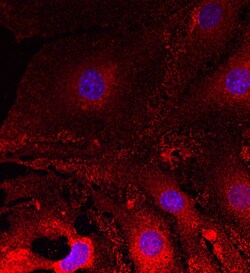 Human/Mouse Plexin A2 Antibody, R D Systems 100ug; Unlabeled:Antibodies,
