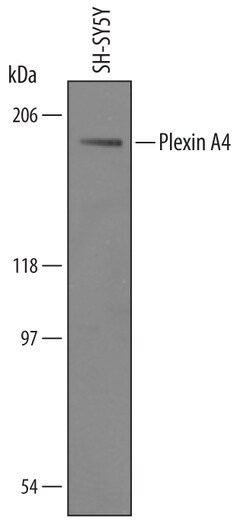 Human Plexin A4 Antibody, R D Systems 100&mu;g; Unlabeled:Antibodies, Polyclonal