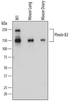 Mouse Plexin B2 Antibody, R D Systems 25&mu;g; Unlabeled:Antibodies, Polyclonal