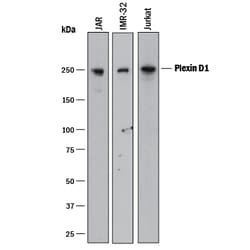 Human Plexin D1 Antibody, R D Systems 100&mu;g; Unlabeled:Antibodies, Polyclonal