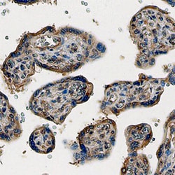 Human PlGF Antibody, R D Systems 100ug; Unlabeled:Antibodies, Monoclonal