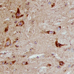 Mouse PLTP Antibody, R D Systems 25&mu;g; Unlabeled:Antibodies, Polyclonal