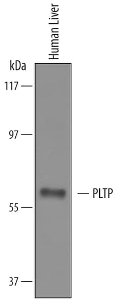 Human PLTP Antibody, R D Systems 100&mu;g; Unlabeled:Antibodies, Polyclonal