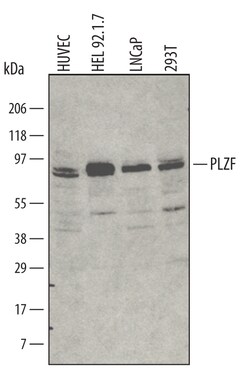 Human PLZF Antibody, R D Systems 25&mu;g; Unlabeled:Antibodies, Polyclonal
