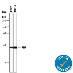 Human Purine Nucleoside Phosphorylase/PNP Antibody, R D Systems 100&mu;g;