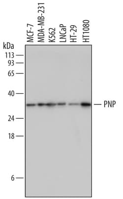 Human Purine Nucleoside Phosphorylase/PNP Antibody, R D Systems 100&mu;g;