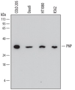 Human Purine Nucleoside Phosphorylase/PNP Antibody, R D Systems 100ug;