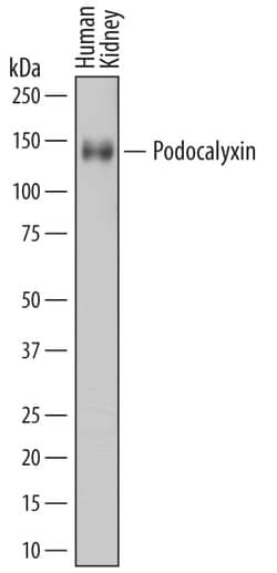Human Podocalyxin Antibody, R D Systems 25&mu;g; Unlabeled:Antibodies,