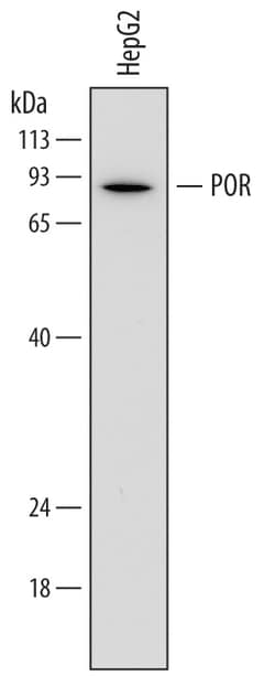 Human POR/Cytochrome P450 Reductase Antibody, R D Systems 25&mu;g; Unlabeled:Antibodies,