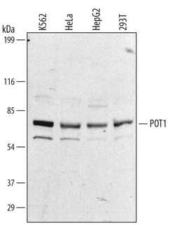 Human POT1 Antibody, R D Systems 100&mu;g; Unlabeled:Antibodies, Polyclonal