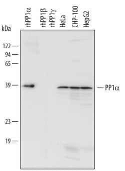 Human PP1 alpha Catalytic Subunit Antibody, R D Systems 100ug; Unlabeled:Antibodies,