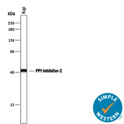 Human/Mouse/Rat PP1 Inhibitor-2 Antibody, R D Systems 25&mu;g; Unlabeled:Antibodies,