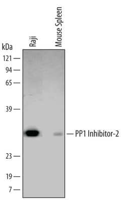 Human/Mouse/Rat PP1 Inhibitor-2 Antibody, R D Systems 25&mu;g; Unlabeled:Antibodies,