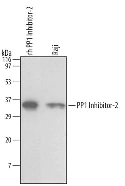 Human PP1 Inhibitor-2 Antibody, R D Systems 25&mu;g; Unlabeled:Antibodies,