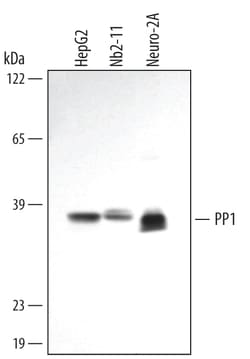 Human/Mouse/Rat PP1 Catalytic Subunit Antibody, R D Systems 25&mu;g; Unlabeled:Antibodies,