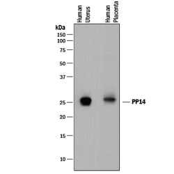Human PP14/Glycodelin Antibody, R D Systems 100&mu;g; Unlabeled:Antibodies,