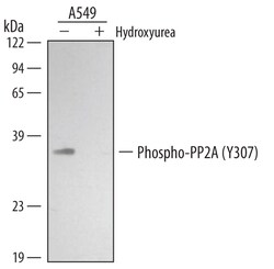 Human/Mouse/Rat Phospho-PP2A (Y307), Catalytic Subunit Antibody, R D Systems