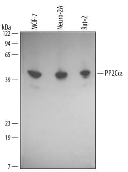 Human/Mouse/Rat PP2C alpha/PPM1A Antibody, R D Systems 100ug; Unlabeled:Antibodies,