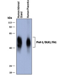 Human Pref-1/DLK1/FA1 Antibody, R D Systems 100&mu;g; Unlabeled:Antibodies,