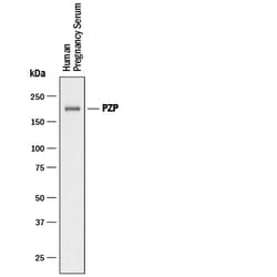 Human Pregnancy Zone Protein/PZP Antibody, R D Systems 25&mu;g; Unlabeled:Antibodies,