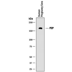 Human Pregnancy Zone Protein/PZP Antibody, R D Systems:Antibodies:Primary