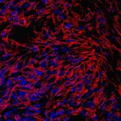 Human PRELP Antibody, R D Systems 25&mu;g; Unlabeled:Antibodies, Polyclonal