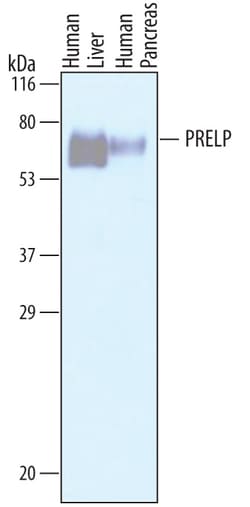 Human PRELP Antibody, R D Systems 25&mu;g; Unlabeled:Antibodies, Polyclonal