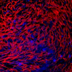 Human PRELP Antibody, R D Systems 100ug; Unlabeled:Antibodies, Monoclonal
