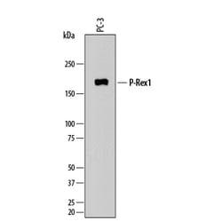 Human P-Rex1 Antibody, R D Systems 100ug; Unlabeled:Antibodies, Monoclonal