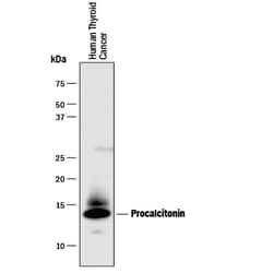 Human Procalcitonin Antibody, R D Systems 100ug; Unlabeled:Antibodies,