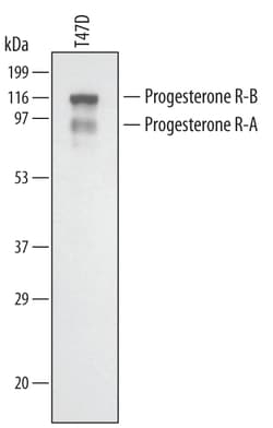Human Progesterone R/NR3C3 Antibody, R D Systems 100 &mu;g | Buy Online | R&D Systems | Fisher Scientific
