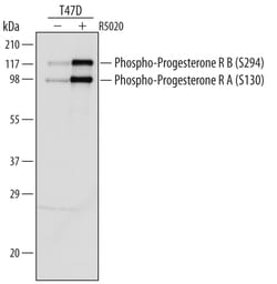 Human Phospho-Progesterone R/NR3C3 (S294) Antibody, R D Systems 25&mu;g;