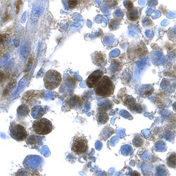 Human Progranulin/PGRN Antibody, R D Systems 100&mu;g; Unlabeled:Antibodies,