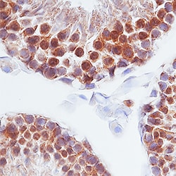 Human Prolactin Antibody, R D Systems 100&mu;g; Unlabeled:Antibodies, Polyclonal