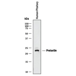 Human Prolactin Antibody, R D Systems 100&mu;g; Unlabeled:Antibodies, Polyclonal